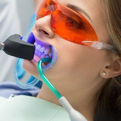 Zoom Teeth Whitening In Dubai Dental Clinic UAE