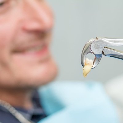 Best Tooth Removal in Dubai | Teeth Extraction Price