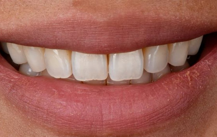 Best Cosmetic Dentistry Dubai