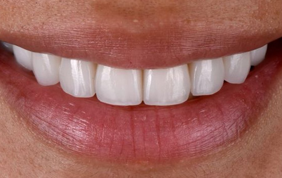 Best Cosmetic Dentistry in Dubai