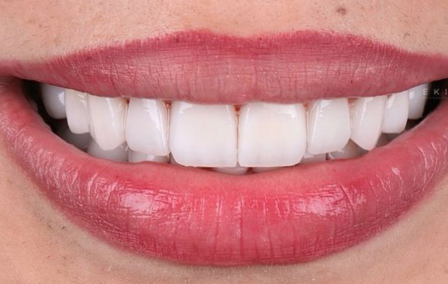 Best Cosmetic Dentistry