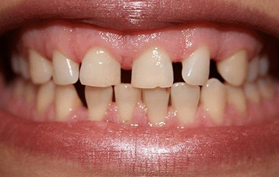 Best Dental X-Ray Dubai Best Dental X-Ray Dubai