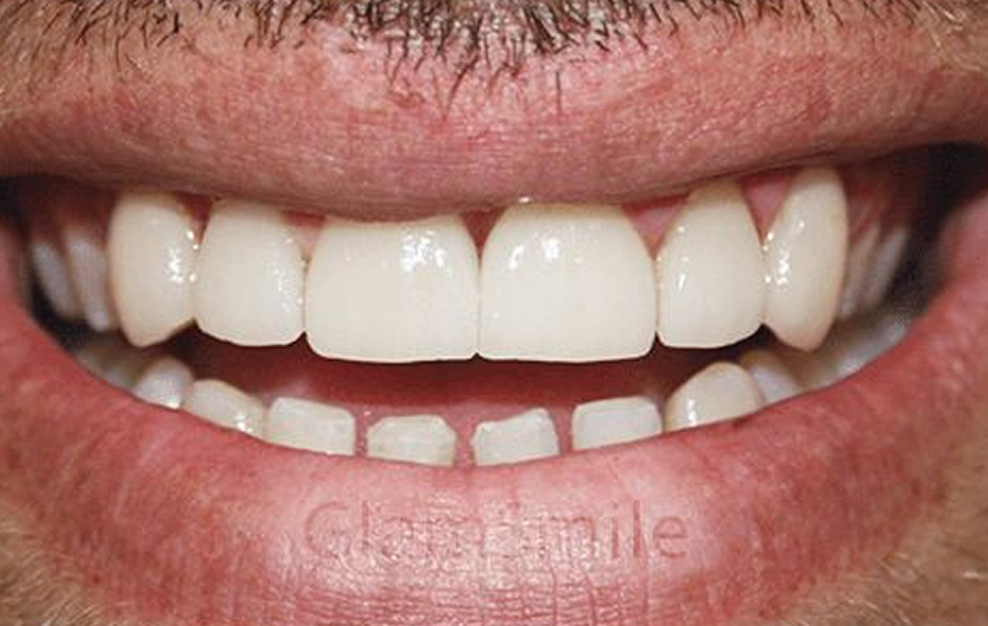 Best Dental X-Ray in Dubai