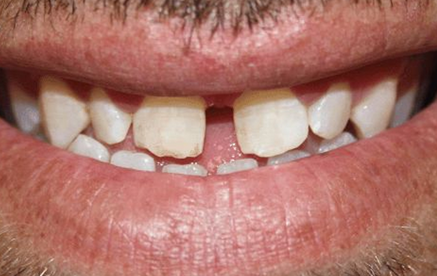 Best Dental X-Ray Best Dental X-Ray