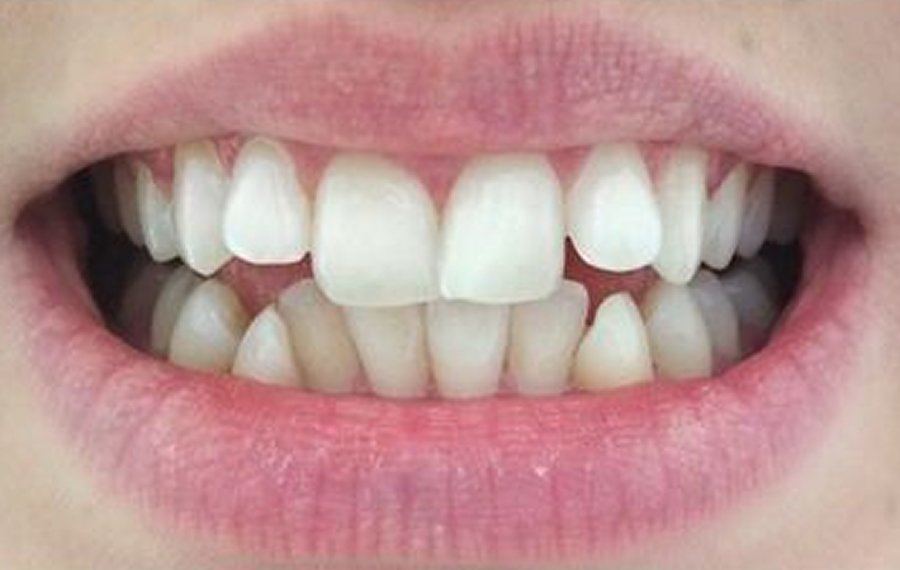 Best General Dentistry Dubai