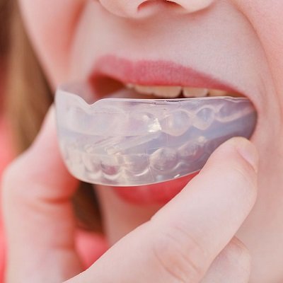 Best Mouth Guards in Dubai Mouthguards Treatment