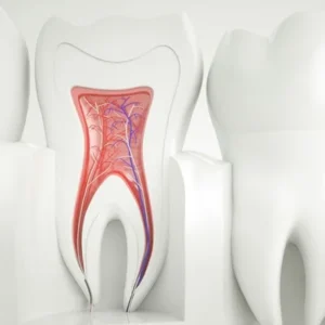 Best-Root-Canal-Treatment-Cost-in-Dubai-Endodontists-Dubai