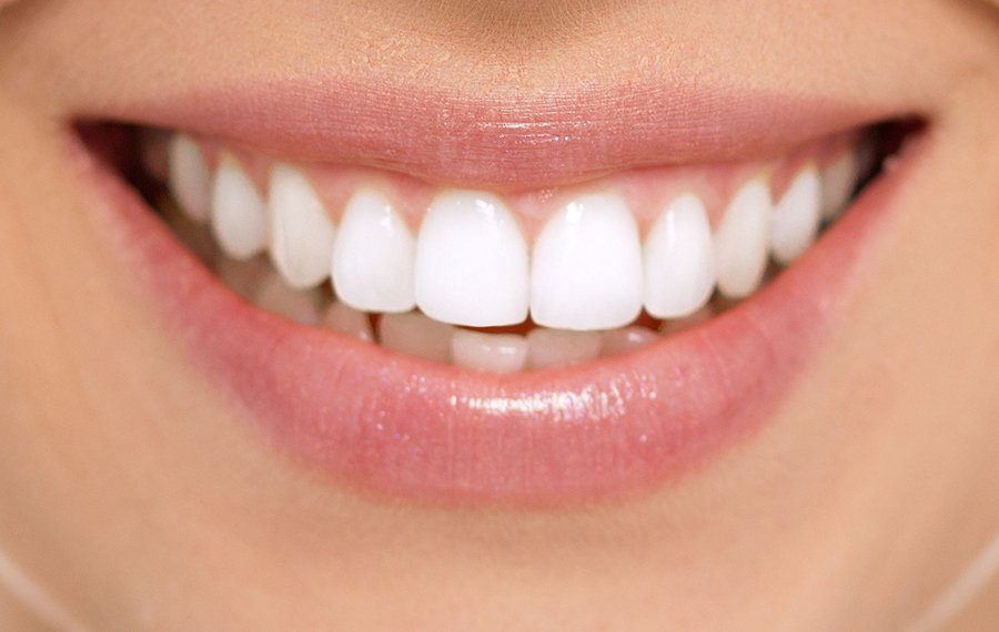 Best Teeth Cleaning Best Teeth Cleaning