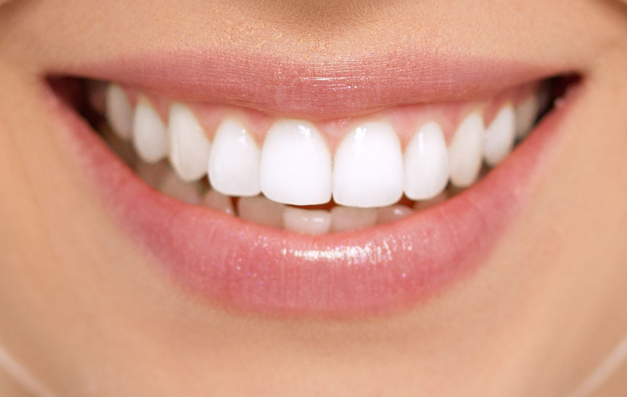 Best Tooth Removal Dubai