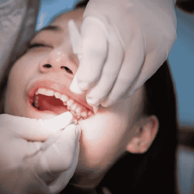 Cheapest Tooth Removal Near Me