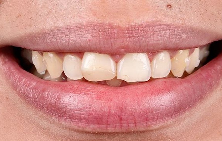 Cosmetic Dentistry in Dubai