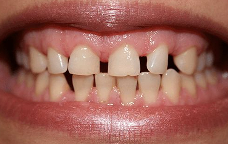 Dental X-Ray in Dubai Dental X-Ray in Dubai