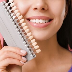 Do dental veneers require a lot of maintenance