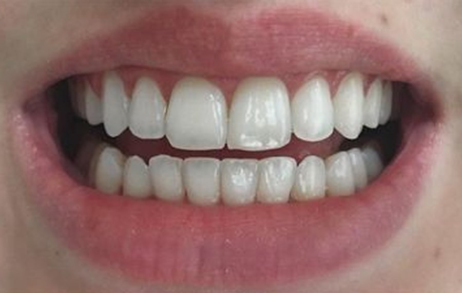 General Dentistry Dubai