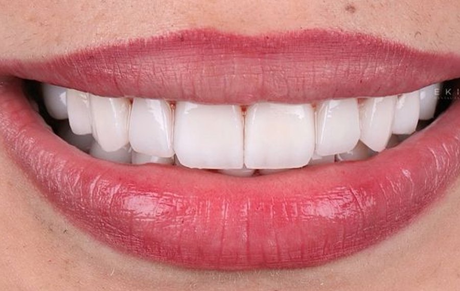 General Dentistry in Dubai