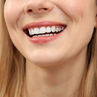 Gingivectomy Surgery in Dubai - Gum Tissue Removal UAE