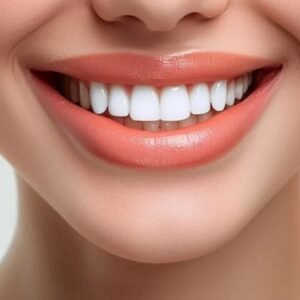 Hollywood Smile Price In Dubai - Digital Smile Design