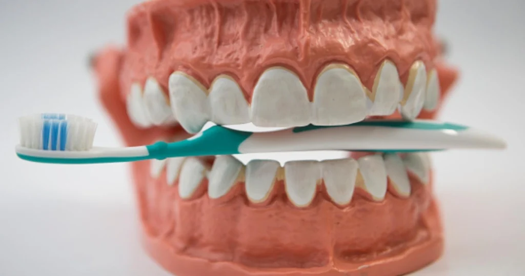 How Long Do Teeth Whitening Results Last