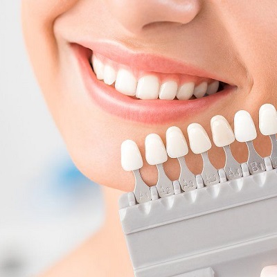 Nano Teeth Whitening In Dubai & Abu Dhabi - Dental Clinic