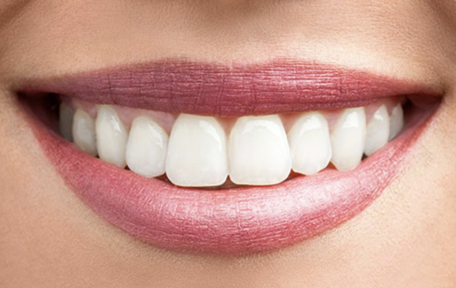 Teeth Cleaning in Dubai Teeth Cleaning in Dubai