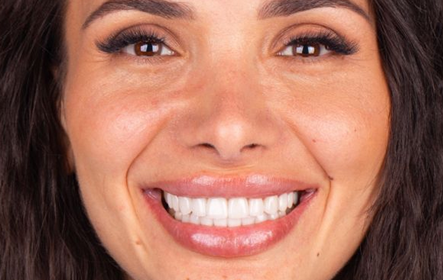 Teeth Whitening Price and Cost