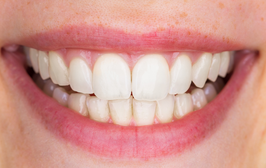 Tooth Removal Dubai