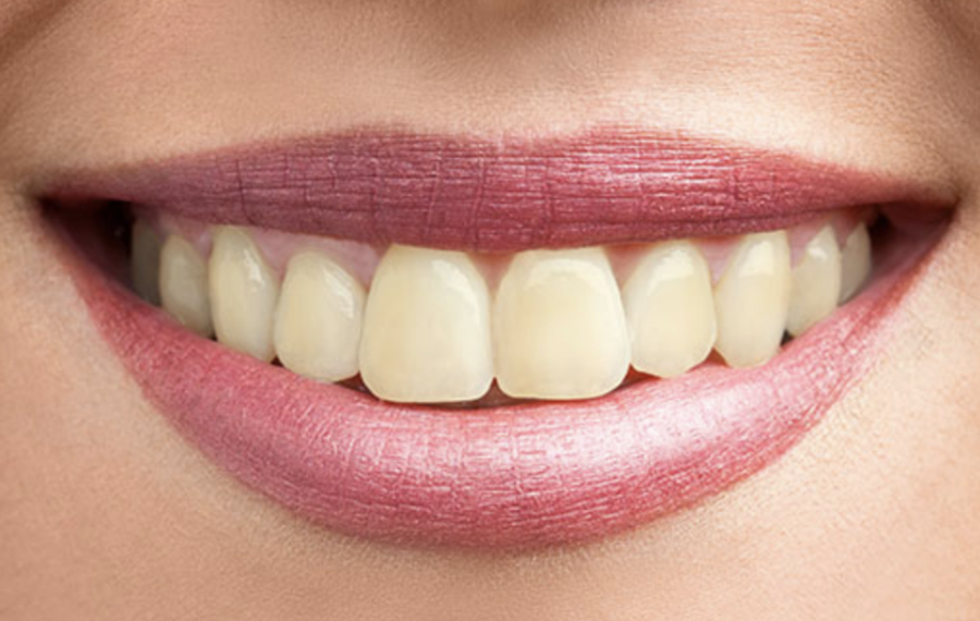 Tooth Removal Tooth Removal