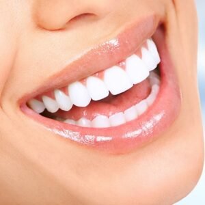 What is the Most Effective Teeth Whitening Method