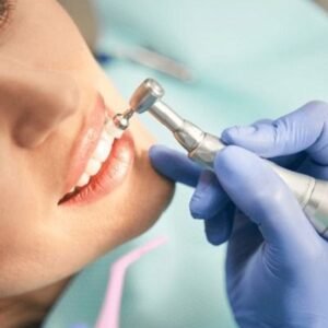 how teeth polishing and scaling can transform your smile