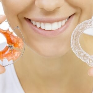 What Are the Different Types of Retainers for Teeth?