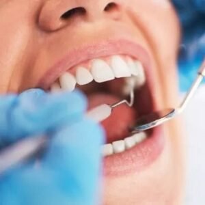 What To Expect From A Root Canal Procedure?