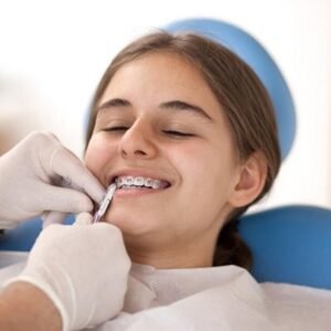 Best Orthodontist Cost In Dubai - Cheap Braces Cost UAE