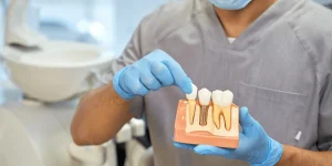 Are Dental Implants Worth It?