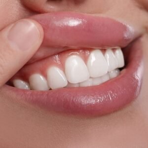 Best Gum Contouring Cost In Dubai - Enfield Dental Clinic